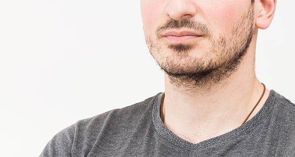 beard-hair-transplant