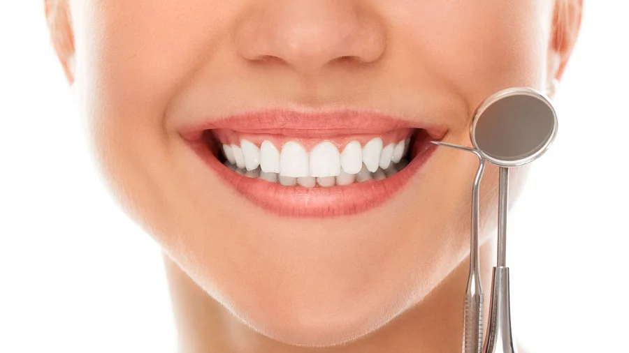 Dental Veneers