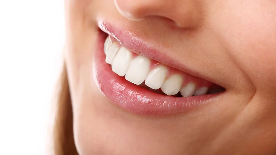 Hollywood Smile
